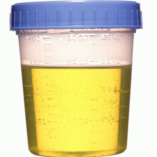 urine-specimen-cup.jpg